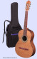 det-camps-sonata-cedar-set.jpg